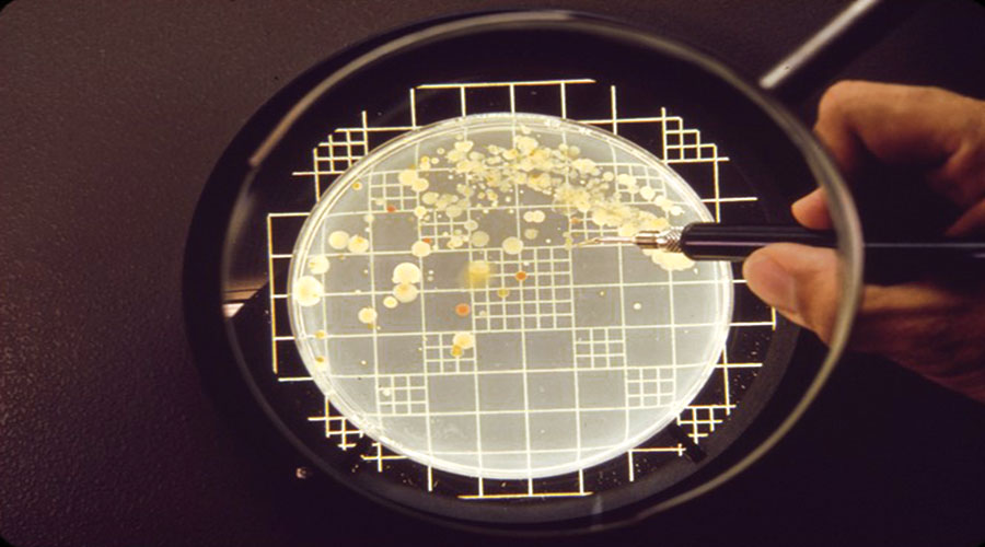 شمارش باکتری‌ها و روش‌های تهیه و شناسایی رقت‌های میکروبی